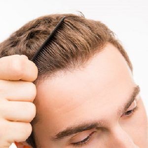 زراعة الشعر بالاقتطاف – 5 أسباب لاختيار واحد