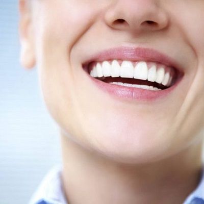نحت اللثة في دبي وأبو ظبي والشارقة علاج الابتسامة اللثوية