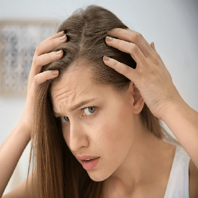 أسباب تساقط الشعر عند الإناث