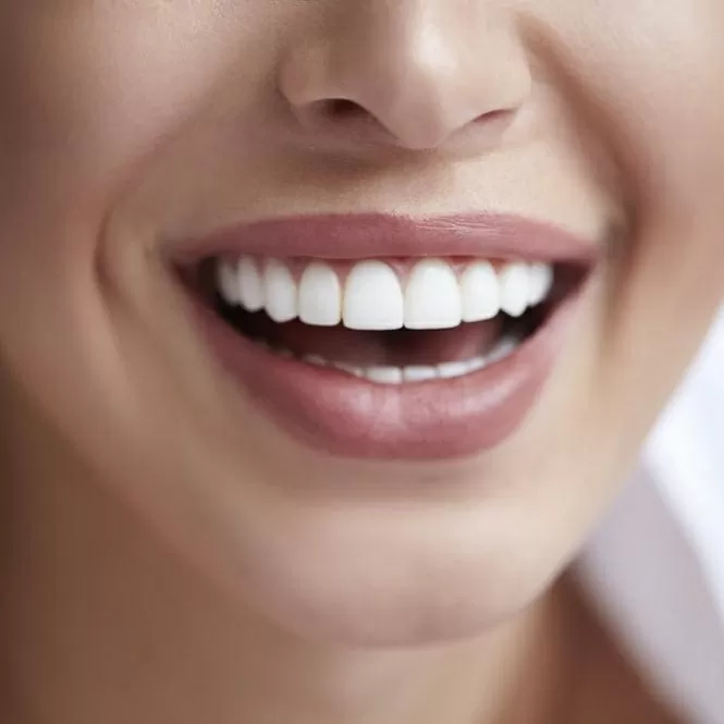 هل من الممكن العودة إلى الأسنان الطبيعية بعد تلبيس الأسنان؟