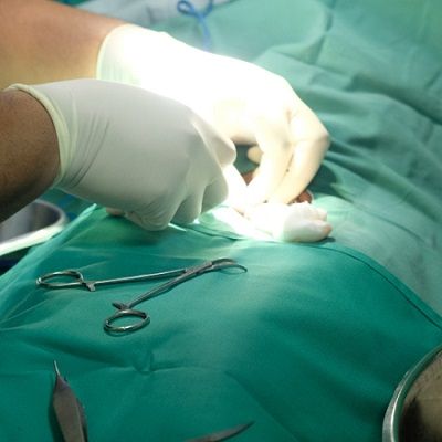 تكلفة جراحة ختان الذكور في دبي والإمارات العربية المتحدة