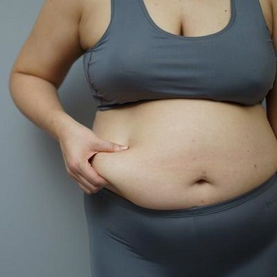 هل تعتبر جراحة إنقاص الوزن حلاً دائمًا السمنة؟