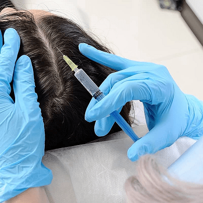 كيف تساعد حقن البلازما الغنية بالصفائح الدموية (بي آر بي)على نمو الشعر في دبي؟