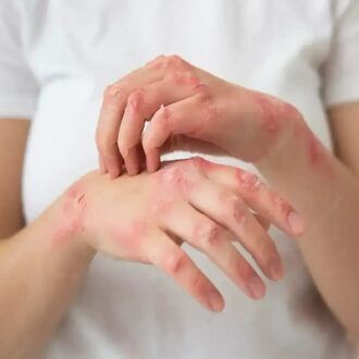طب الجلد الدقيق: علاج الأمراض الجلدية