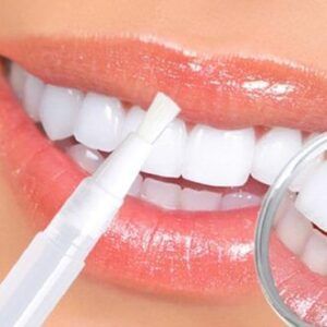 هل التبييض مفيد للأسنان؟