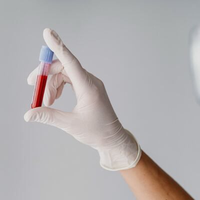 هل اختبارات الدم موثوقة لتحليل صحة الجسم في دبي وأبو ظبي