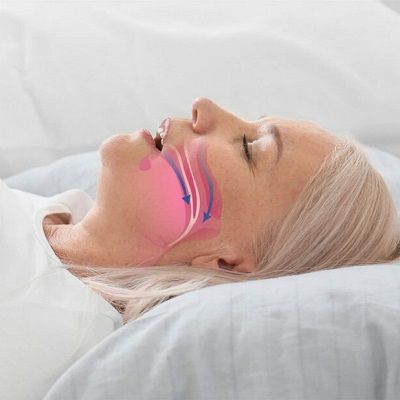 هل العلاج بالليزر يعمل على توقف التنفس أثناء النوم؟