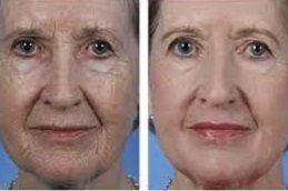 عيادات تجديد البشرة