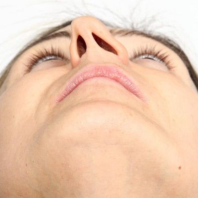 هل السيليكون آمن لعملية تجميل الأنف؟