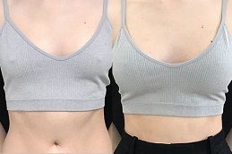 تكبير الثدي في دبي