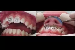 الأجهزة الثابتة في الإمارات العربية المتحدة التكلفة