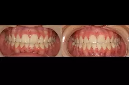 الأجهزة الثابتة