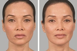 الحشو النحت دبي وأبو ظبي