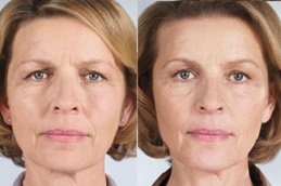 الحشو النحت في دبي وأبو ظبي والشارقة