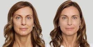 الحشو النحت في دبي وأبو ظبي