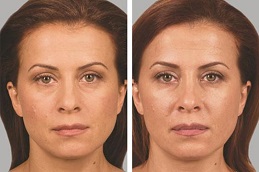 الحشو النحت في دبي والشارقة