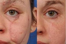 جراحيةمراجعة دبي وأبو ظبي