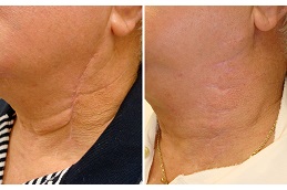 جراحيةمراجعة في دبي وأبو ظبي