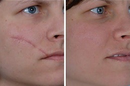 جراحيةمراجعة في دبي