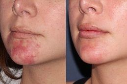 عيادة إزالة الوحمات