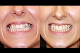 معالجة الأجهزة الثابتة