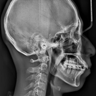 أشعة بانورامية للأسنان في دبي